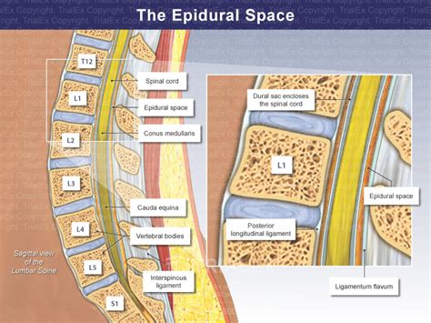The Epidural Space Trial Exhibits Inc