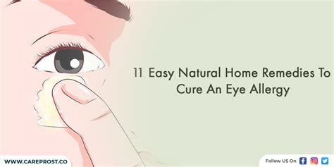 11 Easy Natural Home Remedies To Cure An Eye Allergy