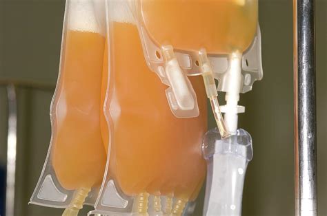 Blood Platelets For Transfusion Photograph By Dr P Marazziscience