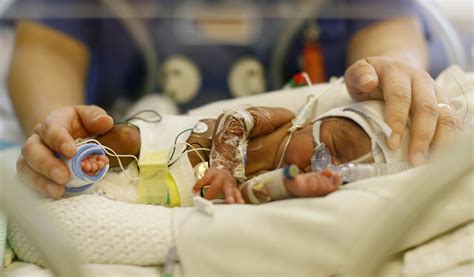 Neonatal Care And Support The Challenges Of Piloting A New Service