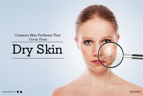 Common Skin Problems That Occur From Dry Skin By Dr G Praneeth Lybrate