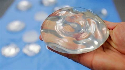 Textured Breast Implants Recalled Due To Ties To Rare Cancer Wset