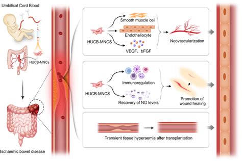 Therapeutic Effect And Study Of Human Umbilical Cord Blood Mononuclear