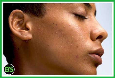 Best Clogged Pores Skincare Routine Say Goodbye To Clogged Pores