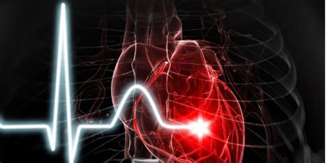 Les Maladies Cardio Vasculaires Les Menus Services