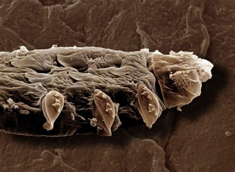 What Are Demodex Mites Facty Health