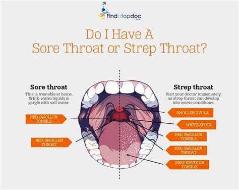 10 Essential Oils For Sore Throat And Rapid Relief