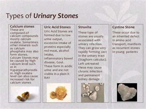 Type Of Urinary Stone Medizzy