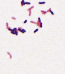 This pathogen is the only gram positive bacterium that produces endotoxin. Image: Gram stain of Listeria monocytogenes in culture ...