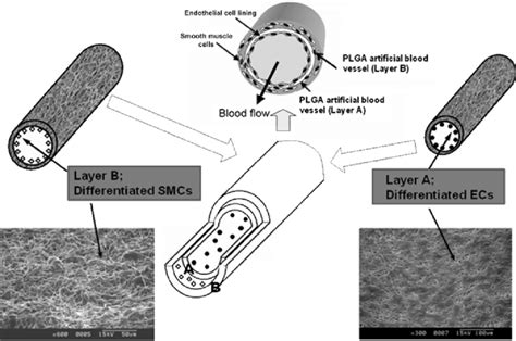 Structure And Components Of Dual Layer Type Artificial Blood Vessel