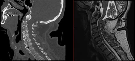 Trauma Joshua Li Md Phd