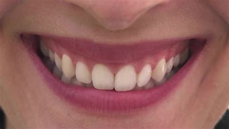 Woman With Beautiful Teeth Smiling Stock Video Motion Array