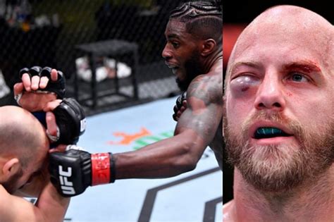 Which Ufc Fighter Sustained Serious Eye Injury At Ufc Vegas 18