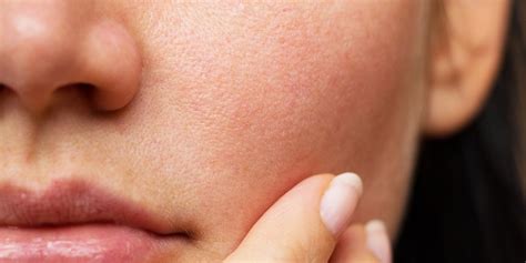 Dry Face Skin The Causes And Treatments To Combat It