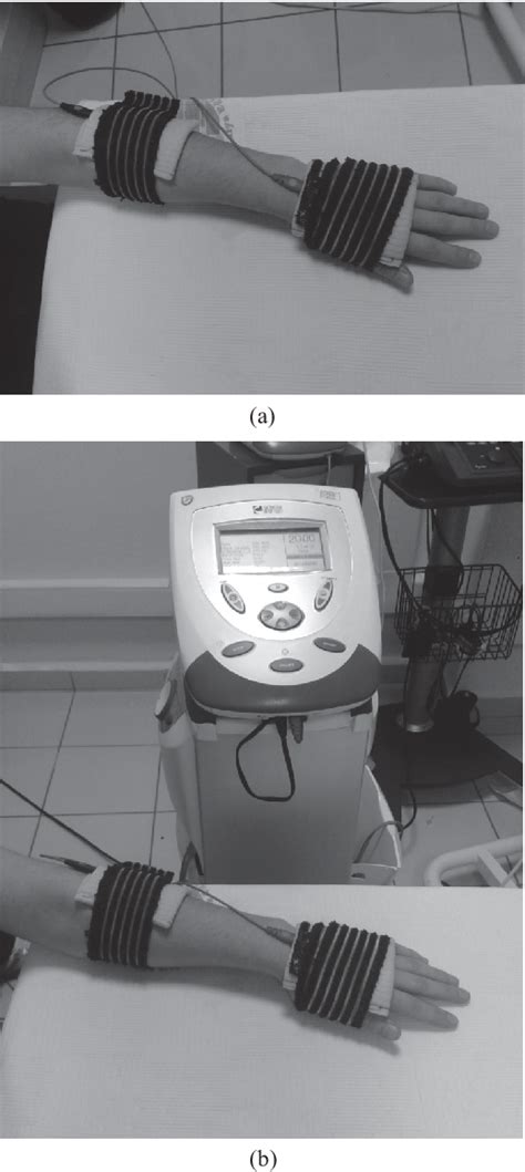 Figure 1 From The Effectiveness Of Transcutaneous Electrical Nerve