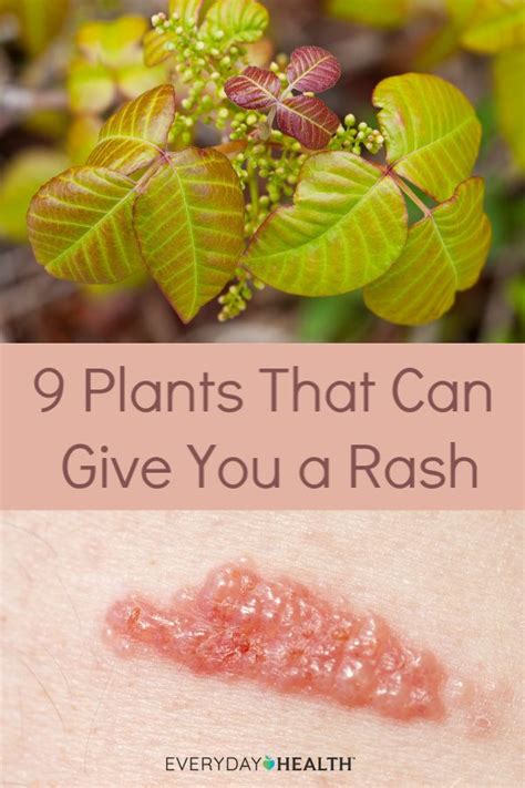 Plants That Can Cause A Rash Everyday Health Plant Rashes Poison