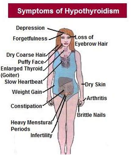 Is Your Thyroid Making You Fat Prettislim