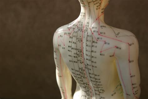 5 Health Benefits Of Acupuncture Comprehensive Medical Care