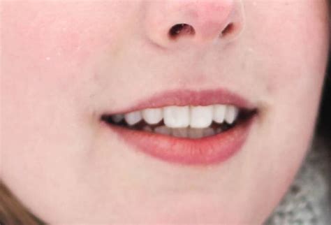 Radiating Tooth Pain That Comes And Goes What To Do