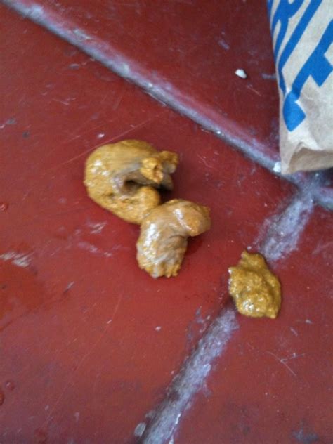 Usually, this falls around the. WORMS-DIARRHEA-HICCUPS