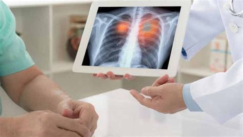What Are The Natural Cures For Lung Cancer Living Well Center