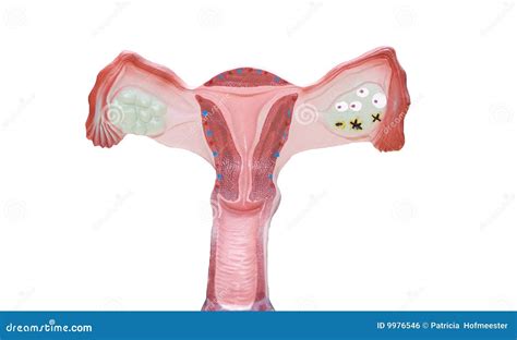 Sistema Reproductivo Femenino Foto De Archivo Imagen De Vagina