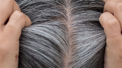 science behind premature hair greying bodywise