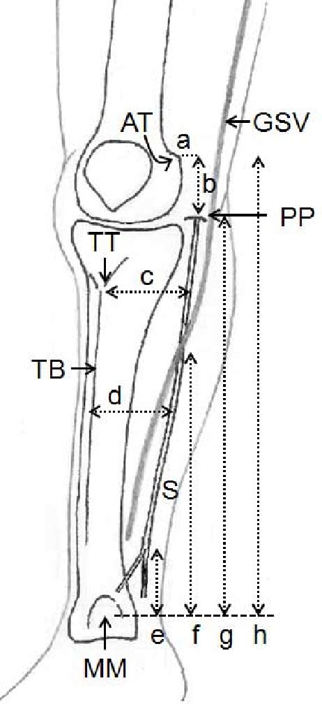 Figure 1 From Sartorial Branch Of Saphenous Nerve Anatomical