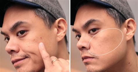 Men Heres How To Cover Up A Pimple How To Treat Prevent Them