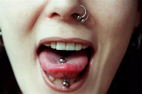 Infected Tongue Piercing What Is It Symptoms Treatment And Best Way To Prevent It