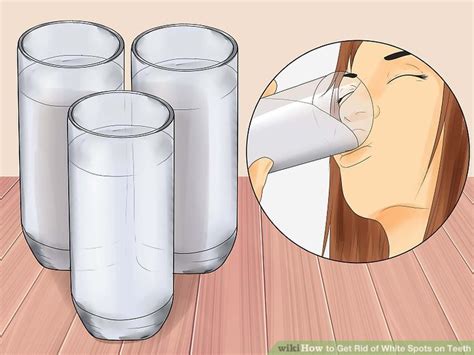 How can you get rid of white spots on your teeth? 3 Ways to Get Rid of White Spots on Teeth - wikiHow