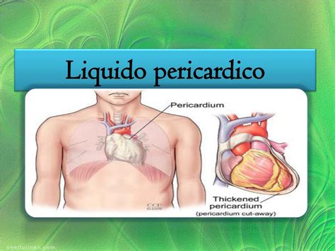 Ppt Liquido Pleural Y Liquido Pericardico Powerpoint Presentation Free Download Id