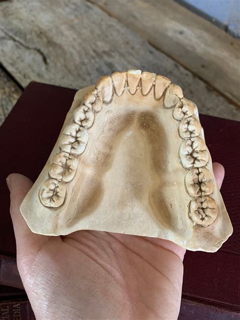 An Oversized Anatomicaldental Plaster Teeth Model Belle And Beast