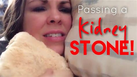 Passing A Kidney Stone Episode 36 Youtube