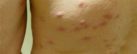 It's yellow to yellow brown in color. WB Pest Control Bedbugs | Las Vegas, NV