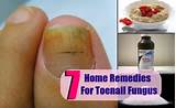Pictures of Home Remedies House