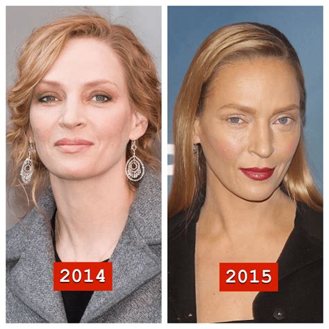 Uma Thurman Has A New Face With Images Plastic Surgery Celebrity Plastic Surgery Under Eye