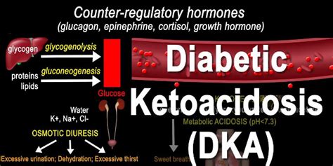 Diabetic Ketoacidosis Vs Hhs