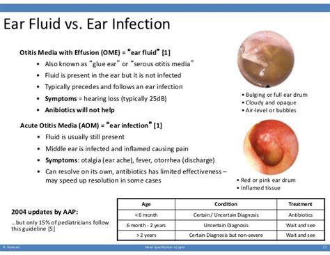 Ear Fluid Vs Ear Infection Otitis Media With Effusion Ome “ear