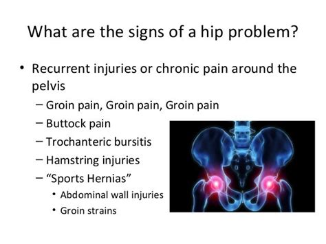 Hip Groin Pain After Sitting Why Hip Flexor Blogs