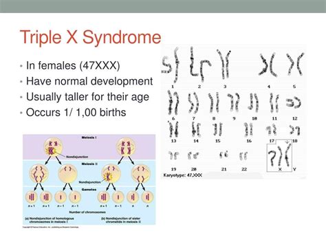 Ppt Karyotypes And Pedigrees Powerpoint Presentation Free Download Id1604957