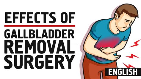 7 Side Effects Of Gallbladder Removal Surgery You Must Know Youtube