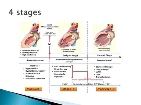 Congestive Heart Failure Stages