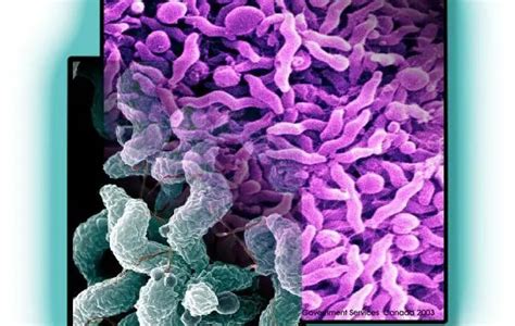 Campylobacter Jejuni Disease Properties And Laboratory Diagnosis
