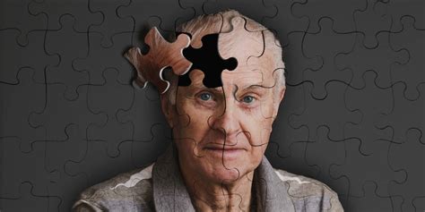 Dementia Or Memory Loss Narain Hospital