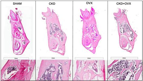 Histological Staining Of Trabecular Bone Hande Staining Buccal Lingual