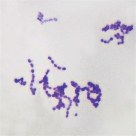 Streptococcus Diplococcus Pneumoniae Wm Microscope Slide Science