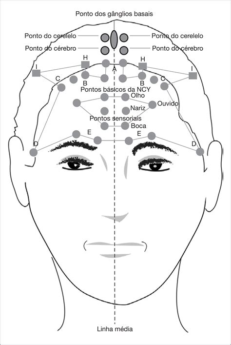 Nova Crâniopuntura De Yamamoto Suas Aplicações E Resultados Em