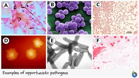 Opportunistic Pathogen Definition And Examples Biology Online