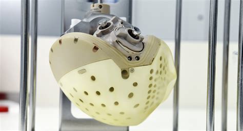 Most Advanced Artificial Heart Approved For Sale In Europe Raising
